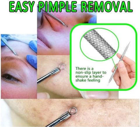 Blackhead Remover Pimple Extractor Popper Tool