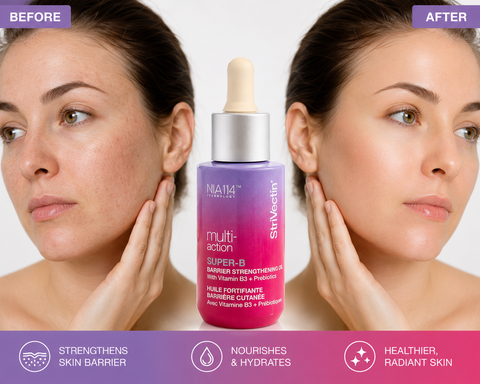 StriVectin Multi-Action Super-B Barrier Strengthening Oil